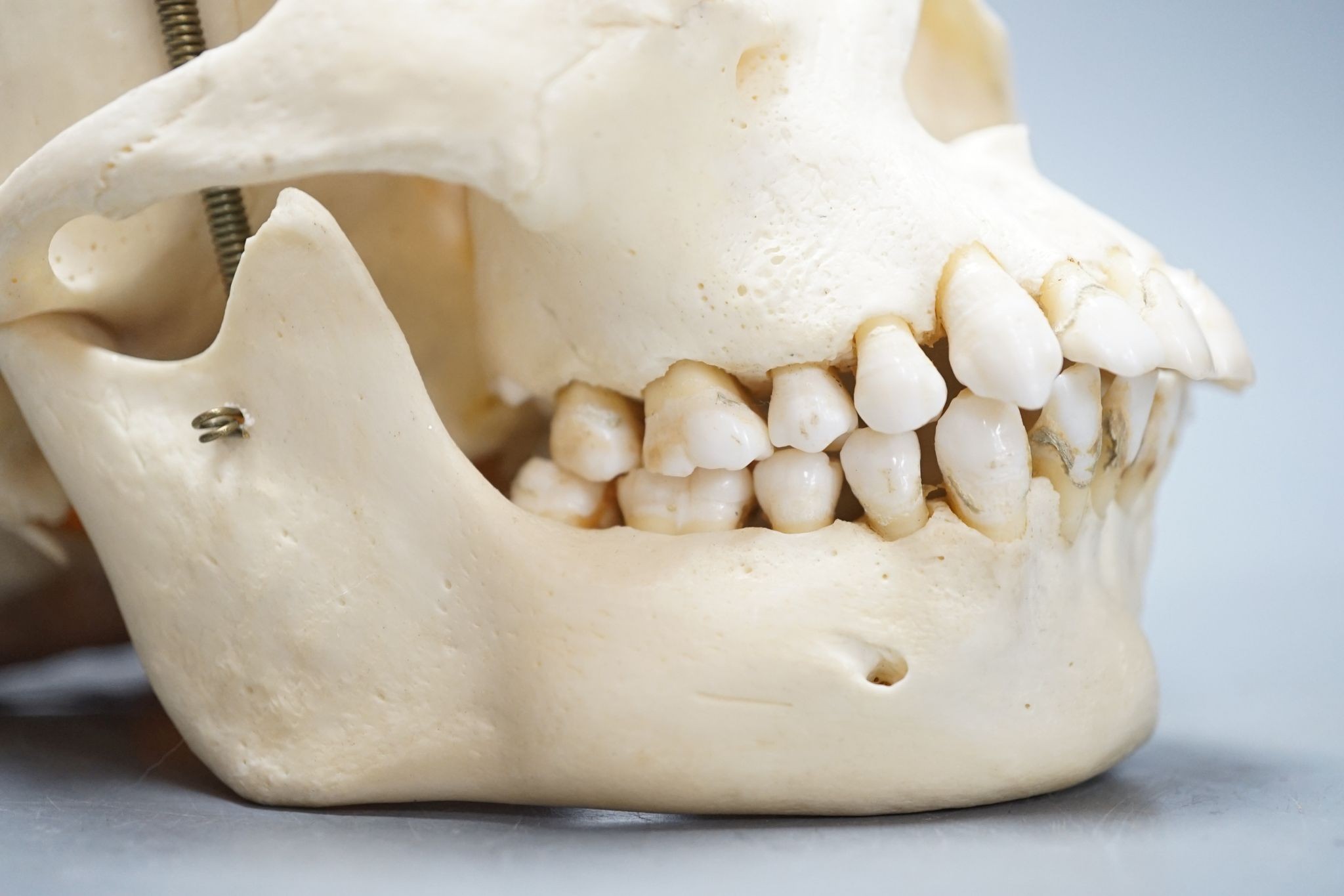 A human skull, acquired c.1976., 14 cms high x 19.5 wide.